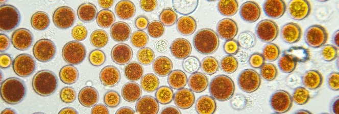 Image de présentation Désintégration de cellules grâce aux broyeurs à billes DYNO®-MILL 